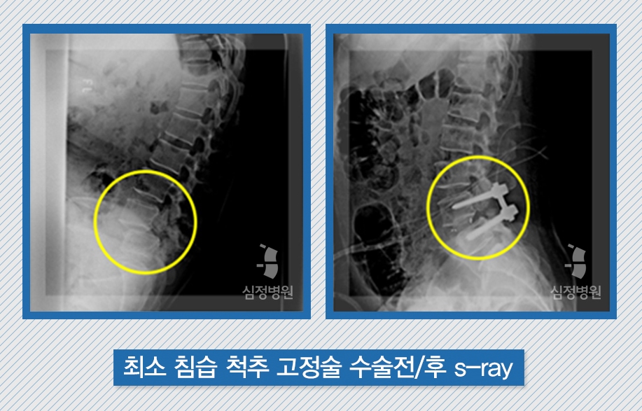 f775202aed8272b62c209a25bcfb8879_1468214