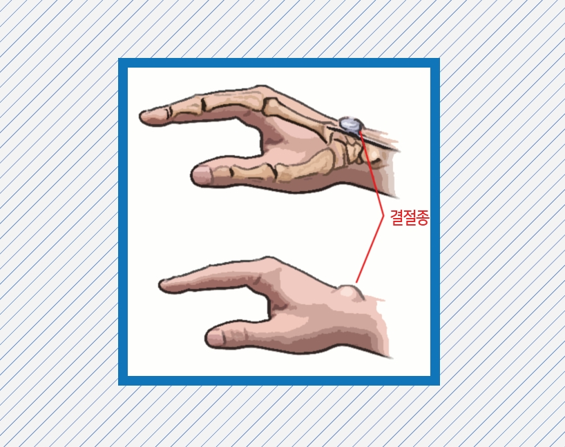 f775202aed8272b62c209a25bcfb8879_1468214