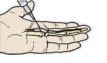 f775202aed8272b62c209a25bcfb8879_1468214412_972.jpg f775202aed8272b62c209a25bcfb8879_1468214