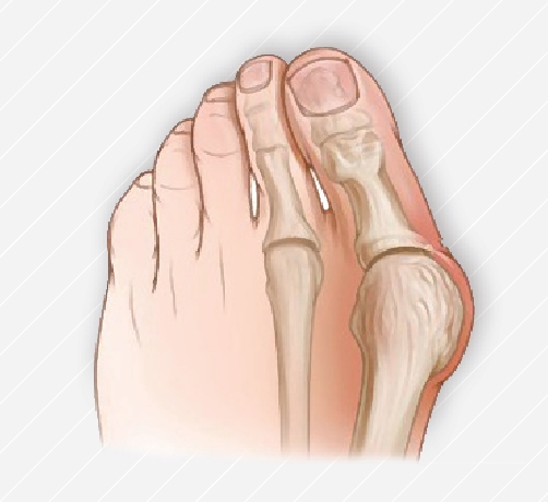 f775202aed8272b62c209a25bcfb8879_1468214