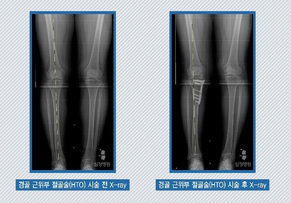 f775202aed8272b62c209a25bcfb8879_1468215