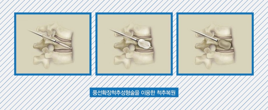 ed0a80756ac517a4056e8288776e8d63_1468286