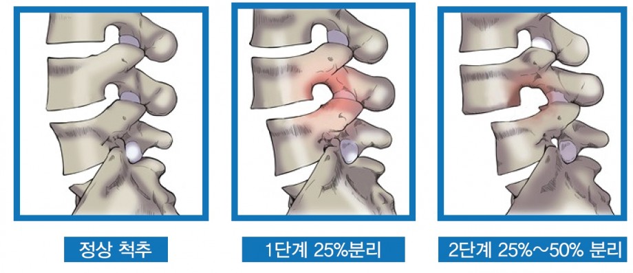 f775202aed8272b62c209a25bcfb8879_1468213