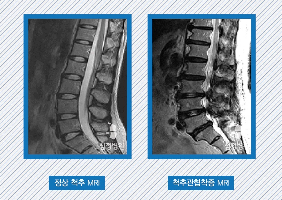 f775202aed8272b62c209a25bcfb8879_1468214