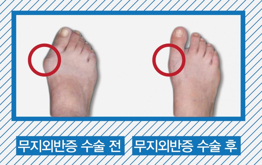 f775202aed8272b62c209a25bcfb8879_1468214