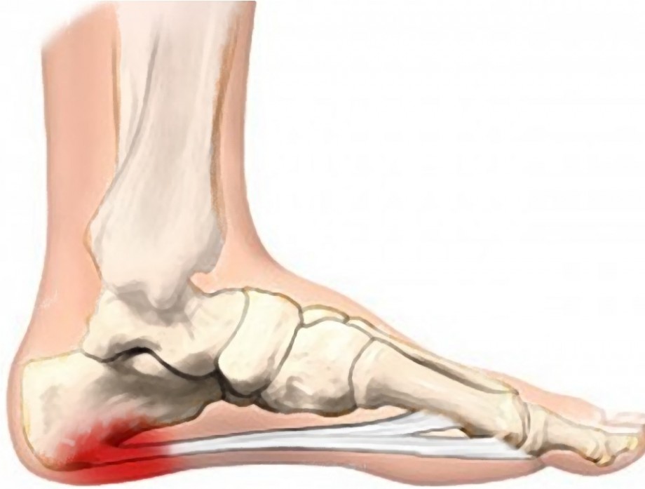 f775202aed8272b62c209a25bcfb8879_1468214