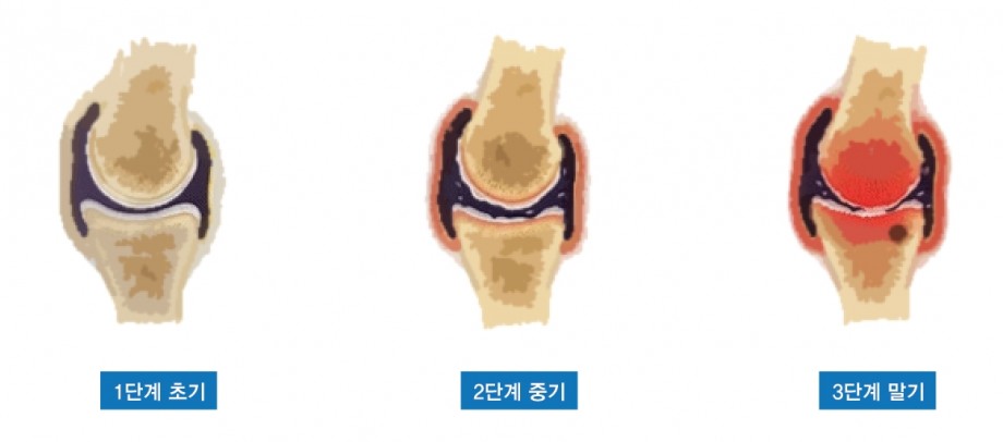 f775202aed8272b62c209a25bcfb8879_1468215